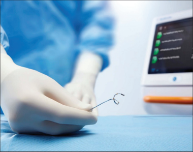  RDN | 經(jīng)腎動(dòng)脈去交感神經(jīng)術(shù)&mdash;&mdash;高血壓微創(chuàng)介入治療